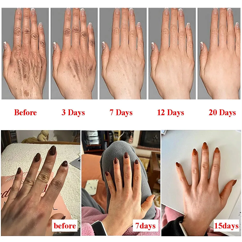 Vitamin E Hand Cream Moisturizing Anti Cracking Nourishing Anti-drying Wrinkle Removal Hand Skin Care Cracked Repair Cosmetics